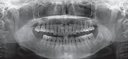 Rayscan α+